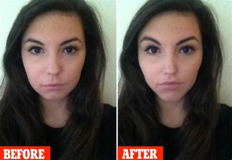 The Plastic Surgery Apps That Allow Users To See Themselves Post