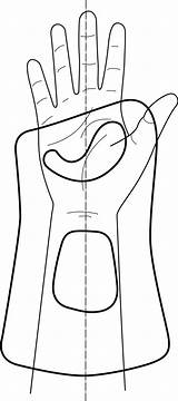Splint Cock Dorsal Wrist Orfit Functional Position Immobilization Objective Radial sketch template