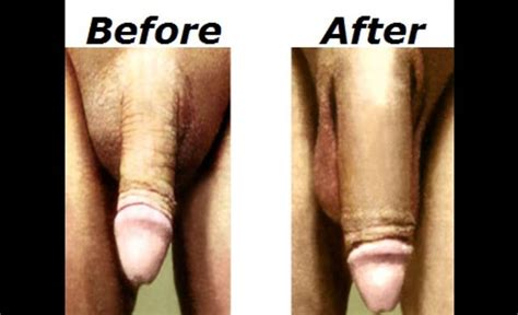 male penis enhancement gay and sex