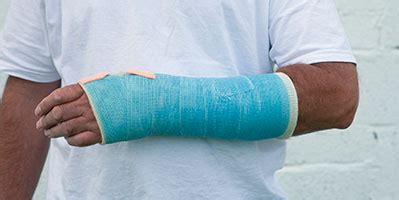 plaster casts  avoid    surgery  common wrist fractures study concludes