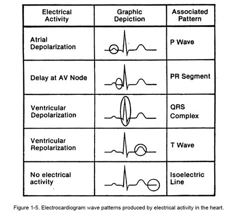 graphic display  electrocardiogram  cardiac rhythm interpretation