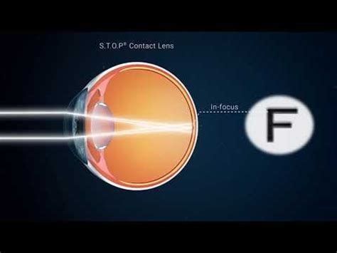 stop contact lens technology explained youtube
