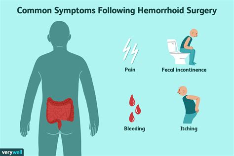 recovering after hemorrhoid surgery