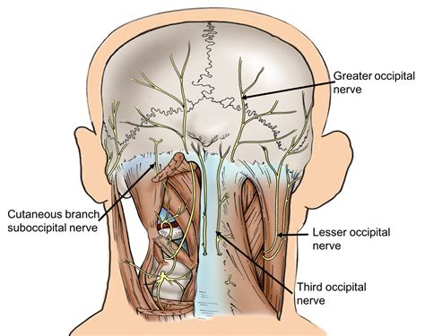 cureus  case report   enlarged suboccipital nerve  cutaneous
