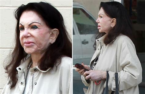 jackie stallone shows the effects of years of excessive plastic surgery