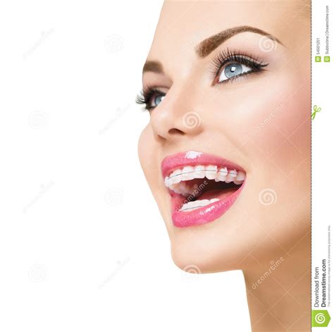 Woman Smiling With Ceramic Braces On Teeth Stock Image