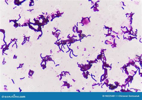 Gram Staining Is A Method Of Differentiating Bacterial Species Gram