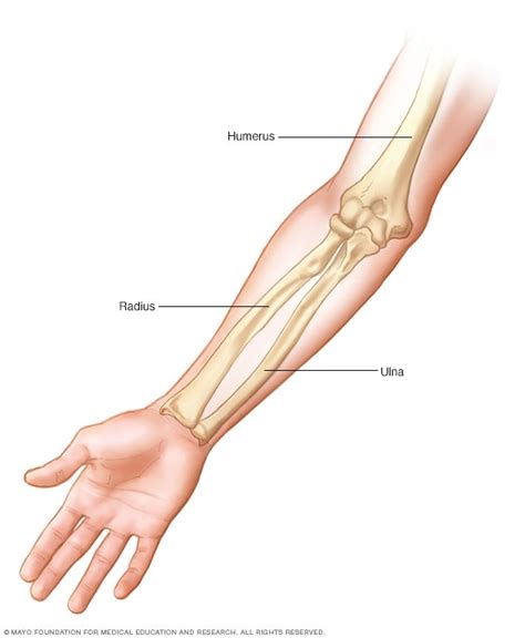 quebradura de brazo sintomas  causas mayo clinic