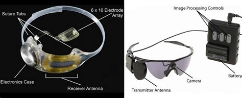 results   year clinical trial show  bionic eye safely restores vision sciencealert