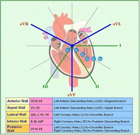 Image Result For Ekg Lead And Mi Paramedic School Critical Care