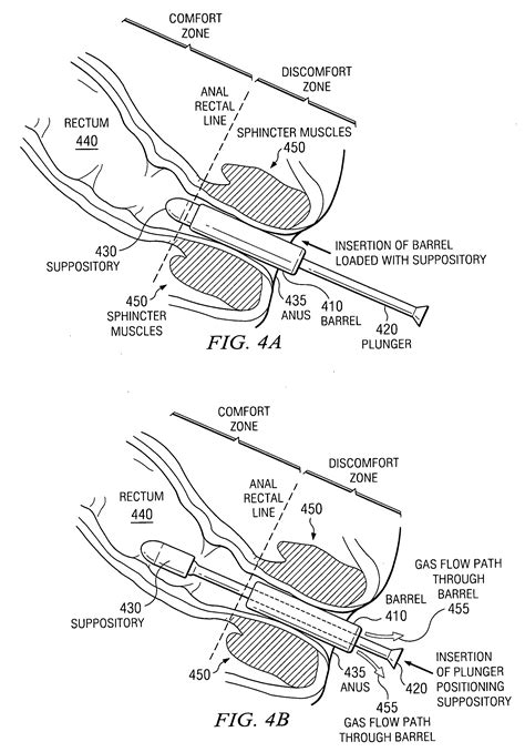 Patent Us20100087797 Method And Apparatus For Inserting A Rectal