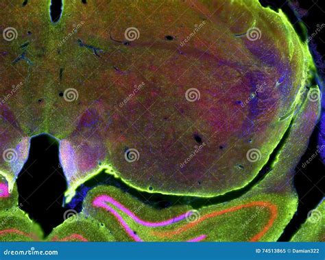 fluorescence view  brain slice stock image image  digital nerve