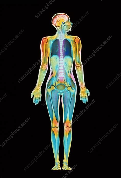 coloured mri scan    human body female stock image p science photo library