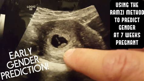 early gender prediction ~ ramzi method ~ 7 weeks pregnant ~ youtube