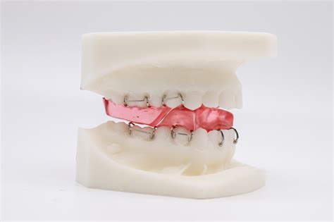functional appliances british orthodontic society bos