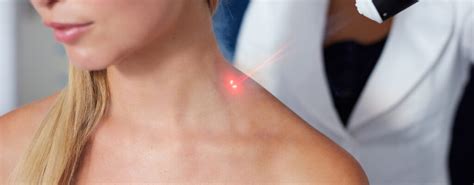 Laser Therapy Bedford Timberlea And Dartmouth Ns Nova Pt
