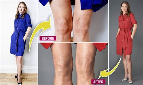 finally a cure for the curse of wrinkly knees daily mail online