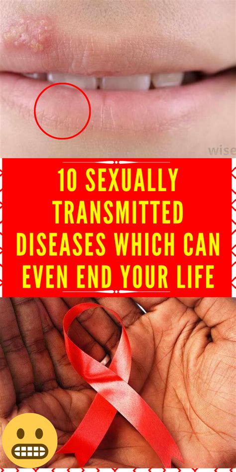 10 sexually transmitted diseases which can even end your life