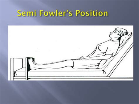 mobility  immobility chapter  powerpoint