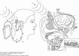 Cochlear Implants Figure sketch template