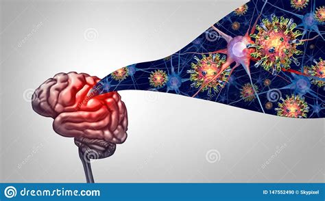 Meningitis Disease Stock Illustration 147552490