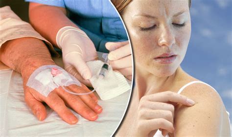 Skin Cancer Cure Modified Herpes Virus Could Cure Symptoms Express