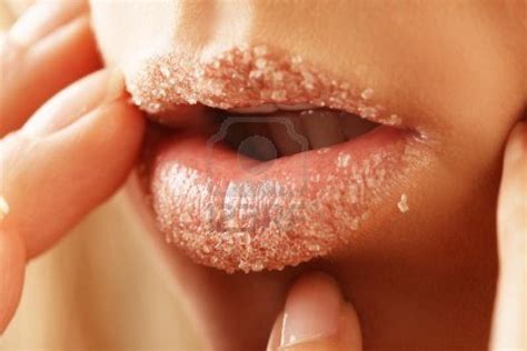 To Remove The Dead Skin On Your Lips You Need To Wet Your Lips With