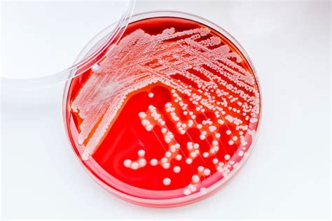 Staphylococcus Aureus Bacteriëmie Een Interdisciplinaire Uitdaging