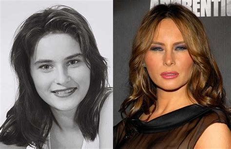 melania trump says she s had zero plastic surgery and is against botox