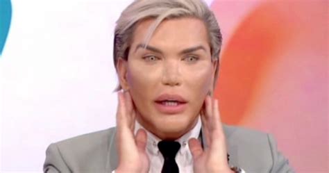 Human Ken Doll Shaken As Teeth Fall Out After Being