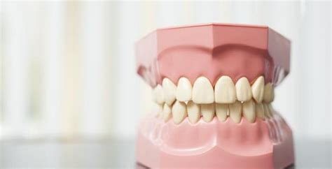cz biedt tandartsen zorgovereenkomst tandprothetiek aan knmt