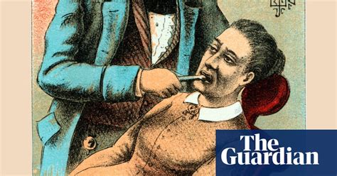 A History Of Dentistry In Pictures Society The Guardian