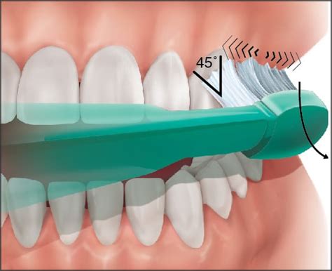 teeth brushing techniques  recommended practices  proper teeth brushing ezza dental care