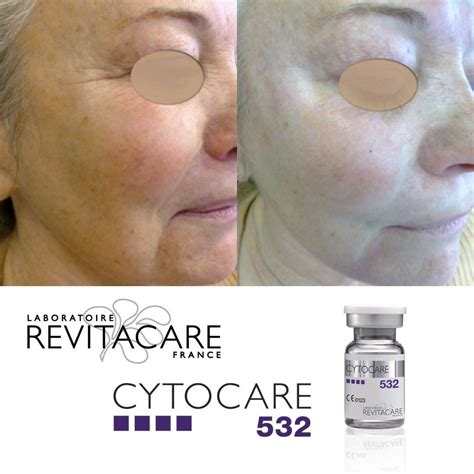 cytocare  revitacare mg  hyaluronic acid