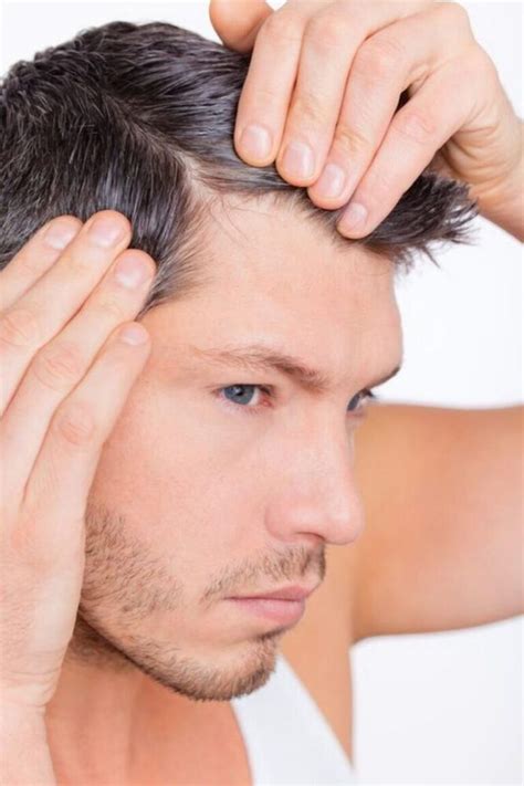 6 reasons why men end up losing their hair demotix