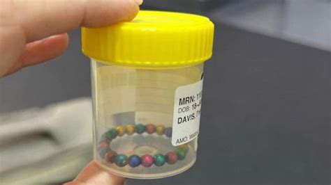 Mums Warning After Young Son Swallows Small Magnetic Toy Balls Nz Herald