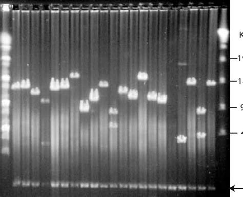 The Pulsed Field Gel Electrophoresis Analysis Of Some Bac Clones