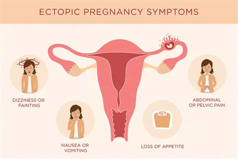 ectopic pregnancy symptoms  treatment