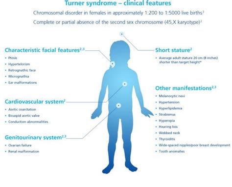 Turners Syndrome Turners Syndrome Info Health Info Pinterest