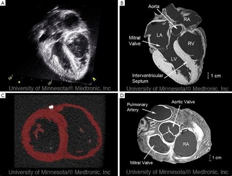 ultrasound   heart       diagnostic health