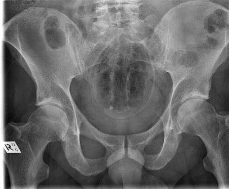 x ray images show the weird and crazy things people shove up their butts