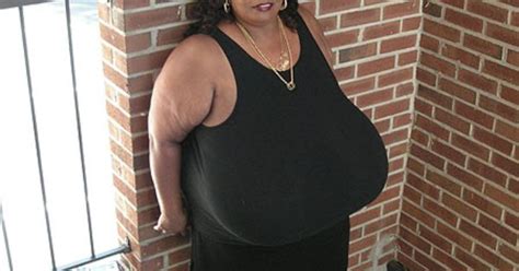 Largest Breasts In The World Record Set By Norma Stitz ~ World Amazing