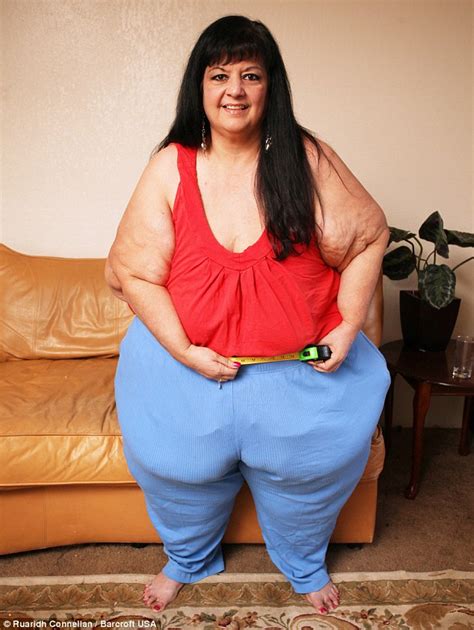Patty Sanchez Loses 238lbs After Severing All Ties With Her Feeder
