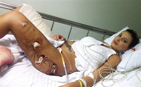 former miss bumbum runner up hospitalized with severe plastic surgery infections photos