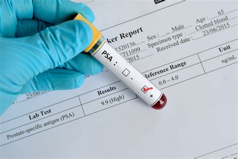 single psa test  asymptomatic men   mortality benefit cancer world archive