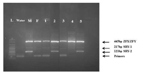 agarose gel obtained after the electrophoresis of 5 dna samples 1and 5