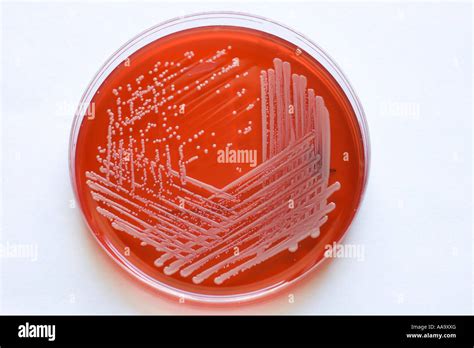 blood  plate growing mrsa bacteria stock photo alamy