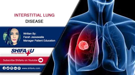 Interstitial Lung Disease