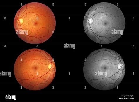 menschliche auge anatomie retina papille arterie und vene
