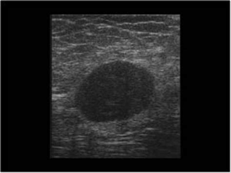 Musculoskeletal Joints And Tendons 6 5 Hip Groin And Buttock Case 6